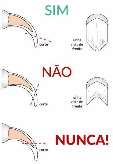 Corta-unhas