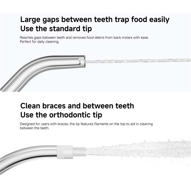 Xiaomi Water Flosser Replacement Tips x4 - Embouts de Remplacement - Ítem1